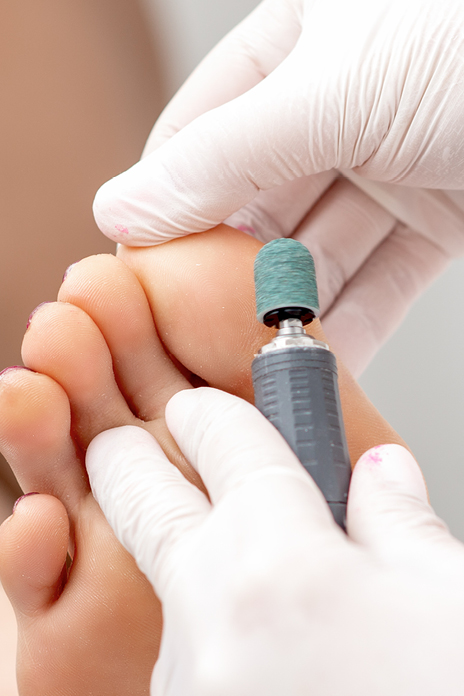 pedicure koersel